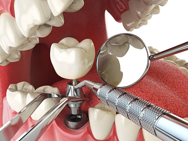 Fast & Reliable Emergency Dental Services in ME